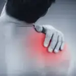 Understanding Inomyalgia A Comprehensive Guide to Chronic Muscle Pain