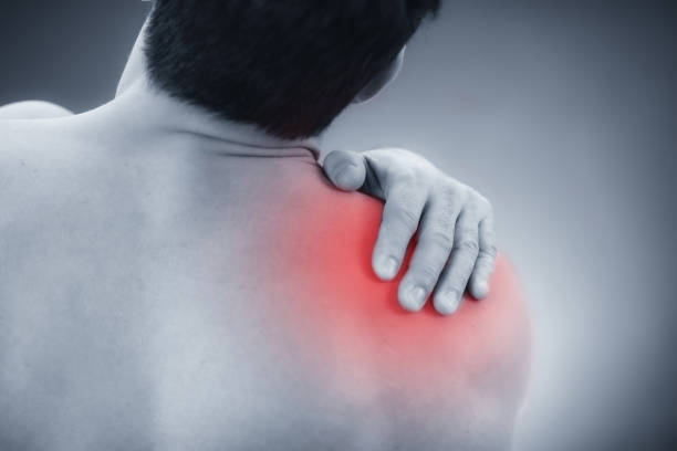 Understanding Inomyalgia: A Comprehensive Guide to Chronic Muscle Pain