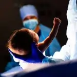 Gastroshiza Understanding This Rare Newborn Condition